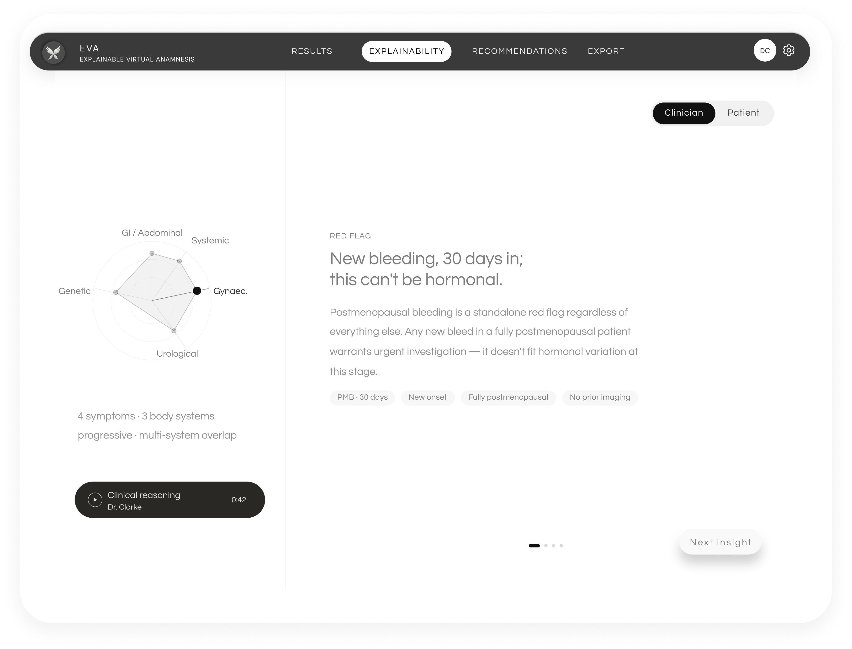 Final EVA explainability screen with a radar chart showing symptom overlap